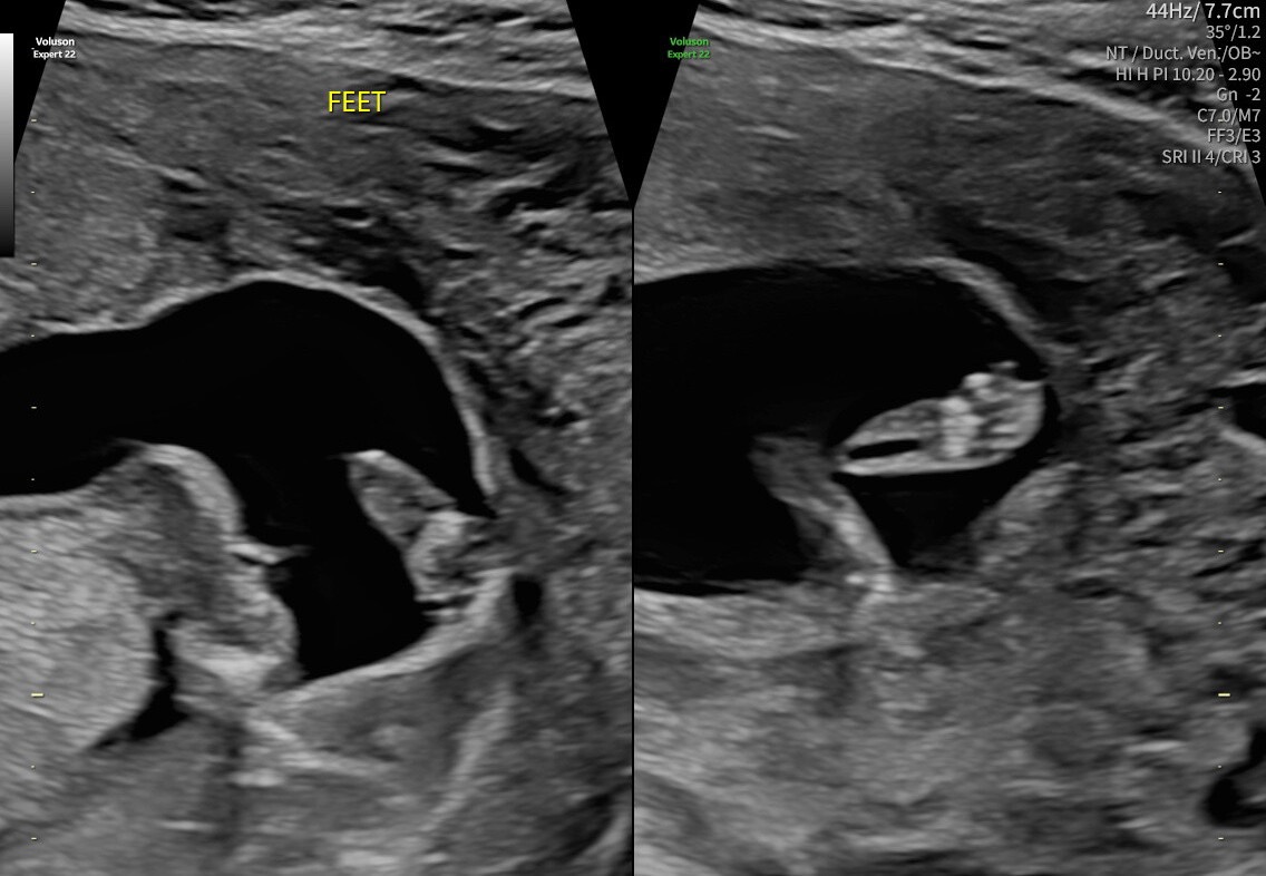 Ultrasound Images