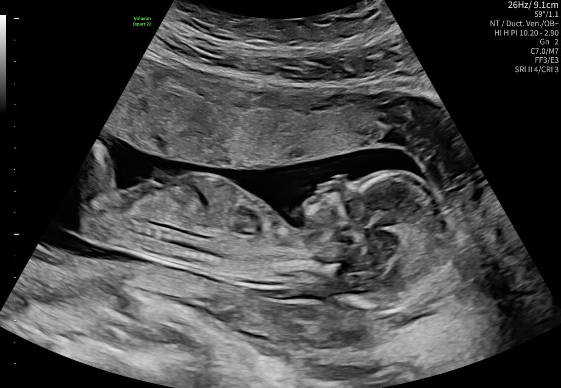 Ultrasound Images