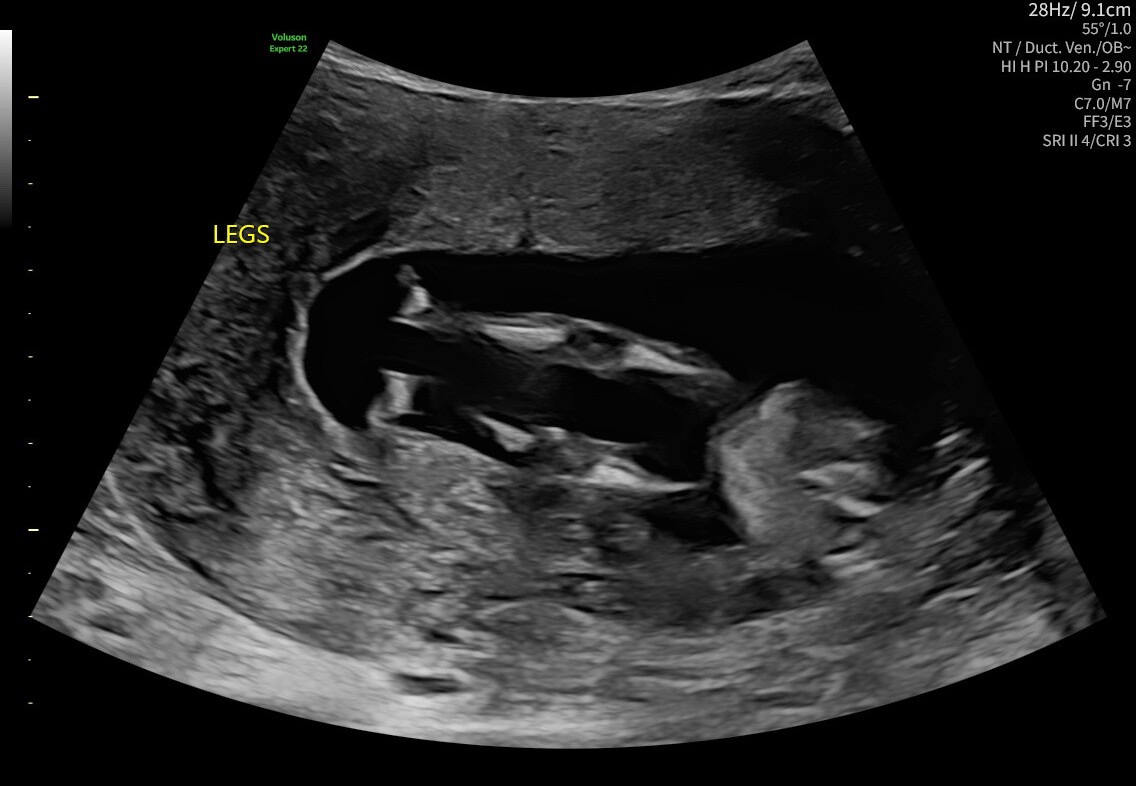 Ultrasound Images