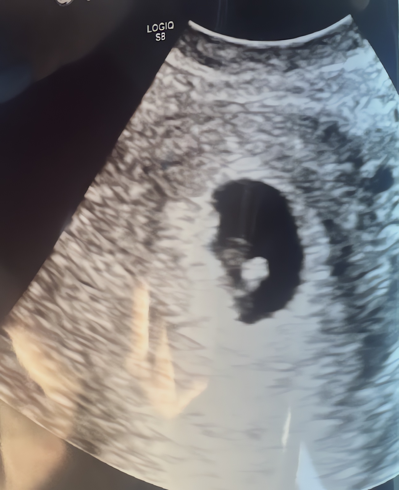 First Ultrasound